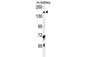 IGSF1 Antibody (C-term) western blot analysis in mouse kidney tissue lysates (35µg/lane). (IGSF1 抗体  (C-Term))