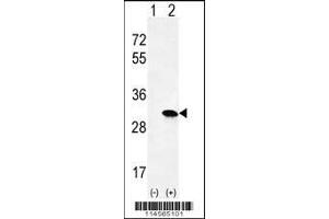 Western blot analysis of HRAS using rabbit polyclonal HRAS Antibody using 293 cell lysates (2 ug/lane) either nontransfected (Lane 1) or transiently transfected (Lane 2) with the HRAS gene. (HRAS 抗体  (C-Term))