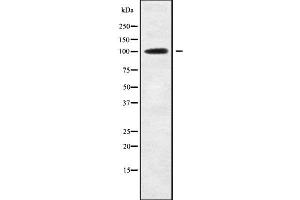 Western blot analysis of ETAA1 using RAW264. (ETAA1 抗体  (Internal Region))