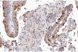 ABIN6266898 at 1/100 staining human Fallopian tube tissue sections by IHC-P. (UBXN11 抗体  (Internal Region))