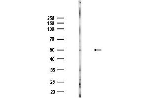 Western blot analysis of lysates from Hela cells(heat-shock,45 min treatment), using SMY Antibody at 1/1000 dilution.