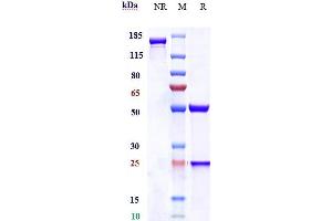 Anti-CEACAM5 / CEA / CD66e Reference Antibody (labetuzumab) on SDS-PAGE under reducing (R) condition. (Recombinant CEACAM5 (Labetuzumab Biosimilar) 抗体)
