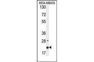 Western blot analysis of MS4A4A Antibody (N-term) in MDA-MB435 cell line lysates (35ug/lane). (MS4A4A 抗体  (N-Term))