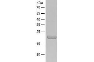 N6AMT1 Protein (AA 1-214) (His tag)