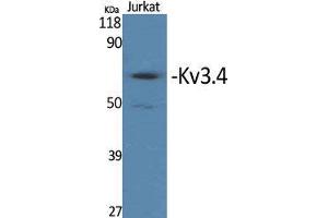 Western Blot (WB) analysis of specific cells using Kv3. (Kv3.4 抗体  (Ser676))