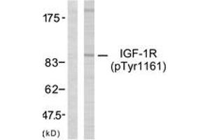 Western blot analysis of extracts from 293 cells treated with Insulin, using IGF1R (Phospho-Tyr1161) Antibody. (IGF1R 抗体  (pTyr1161))