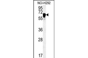 TTC26 Antibody (C-term) (ABIN651518 and ABIN2840274) western blot analysis in NCI- cell line lysates (35 μg/lane). (TTC26 抗体  (C-Term))