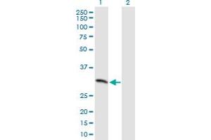 Western Blot analysis of MCART1 expression in transfected 293T cell line by MCART1 MaxPab polyclonal antibody. (MCART1 抗体  (AA 1-297))