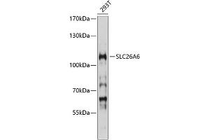 Western blot analysis of extracts of 293T cells, using SLC26 antibody (ABIN6129129, ABIN6147938, ABIN6147939 and ABIN6214535) at 1:1000 dilution. (SLC26A6 抗体  (AA 509-758))