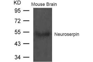 Western blot analysis of extract from Mouse brain tissue using Neuroserpin Antibody (Neuroserpin 抗体)