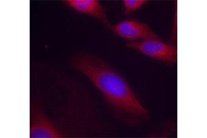 Immunofluorescence staining of methanol-fixed Hela cells using Phospho-RELA-S536 antibody. (NF-kB p65 抗体  (pSer536))