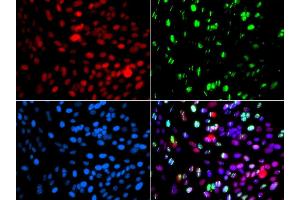 Immunofluorescence analysis of GFP-RNF168 transgenic U2OS cells using POLD3 antibody.