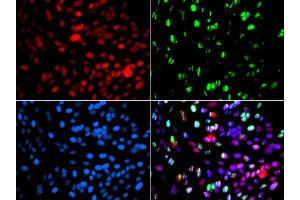 Immunofluorescence analysis of GFP-RNF168 transgenic U2OS cells using POLD3 antibody. (POLD3 抗体  (AA 197-466))