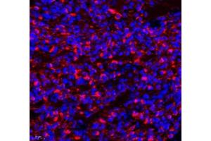 Immunofluorescence (Paraffin-embedded Sections) (IF (p)) image for anti-Mal, T Cell Differentiation Protein 2 (MAL2) antibody (ABIN7074549)