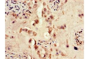 Immunohistochemistry of paraffin-embedded human placenta tissue using ABIN7167466 at dilution of 1:100 (ERBB4 抗体  (AA 1027-1204))