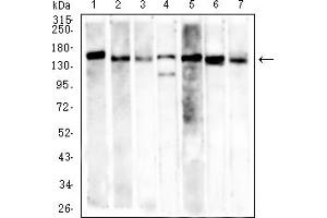 Western Blotting (WB) image for anti-MutS Homolog 6 (E. Coli) (MSH6) (AA 374-540) antibody (ABIN7193700)