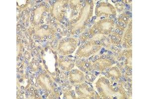 Immunohistochemistry of paraffin-embedded Rat kidney using Myelin Basic protein Polyclonal Antibody at dilution of 1:200 (40x lens). (MBP 抗体)