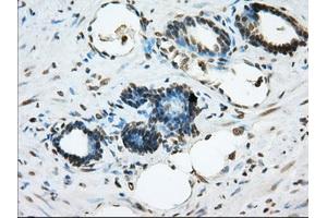 Immunohistochemical staining of paraffin-embedded prostate tissue using anti-ERCC1 mouse monoclonal antibody. (ERCC1 抗体)