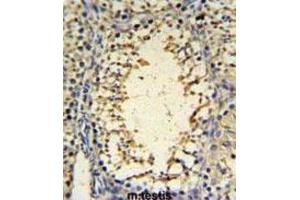 Immunohistochemistry (IHC) image for anti-IMP3, U3 Small Nucleolar Ribonucleoprotein (IMP3) antibody (ABIN3004369) (IMP3 抗体)