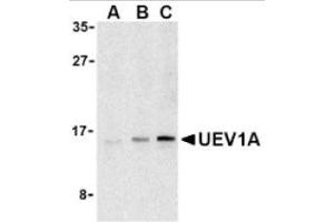 Image no. 1 for anti-Ubiquitin-Conjugating Enzyme E2 Variant 1 (UBE2V1) (C-Term) antibody (ABIN265158) (UBE2V1 抗体  (C-Term))