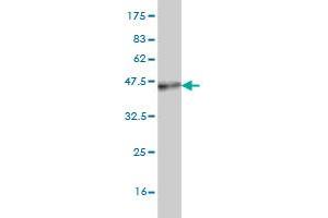 Western Blotting (WB) image for anti-Proprotein Convertase Subtilisin/kexin Type 1 (PCSK1) (AA 652-753) antibody (ABIN562137)