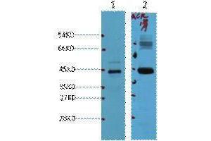 Western Blotting (WB) image for anti-alpha-Methylacyl-CoA Racemase (AMACR) antibody (ABIN3181117) (AMACR 抗体)