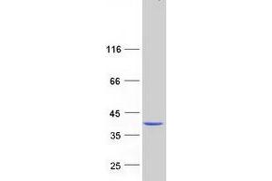 Western Blotting (WB) image for Abhydrolase Domain Containing 6 (ABHD6) protein (Myc-DYKDDDDK Tag) (ABIN2714279)