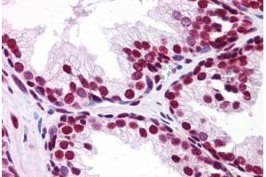 Human Prostate: Formalin-Fixed, Paraffin-Embedded (FFPE) (UBA2 抗体  (C-Term))