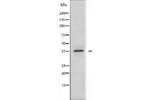 Western blot analysis of extracts from MCF-7 cells, using ABHD9 antibody. (ABHD9 抗体  (N-Term))