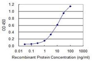 Detection limit for recombinant GST tagged IRX6 is 0. (IRX6 抗体  (AA 337-446))