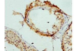Immunohistochemistry of paraffin-embedded human testis tissue using ABIN7144362 at dilution of 1:100