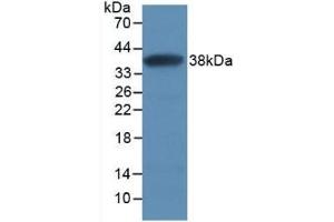 Detection of Recombinant SFRP1, Human using Monoclonal Antibody to Secreted Frizzled Related Protein 1 (SFRP1) (SFRP1 抗体  (AA 32-314))