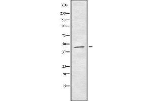 Western blot analysis of HOXB3 using K562 whole cell lysates (HOXB3 抗体  (C-Term))