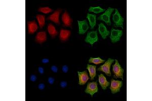ABIN7094361 and ABIN7098408 staining HepG2 cells by IF/ICC. (MIPEP 抗体  (C-Term))