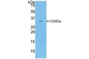 Detection of Recombinant PKN1, Human using Polyclonal Antibody to Protein Kinase N1 (PKN1)