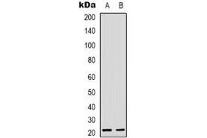 Western blot analysis of RhoG expression in Hela (A), Jurkat (B) whole cell lysates. (RHOG 抗体)