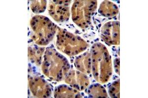 Immunohistochemistry analysis in formalin fixed and paraffin embedded human stomach tissue reacte with Plakophilin-2 Antibody (C-term) followed whcih was peroxidase conjugated to the secondary antibody and followed by DAB staining. (Plakophilin 2 抗体  (C-Term))