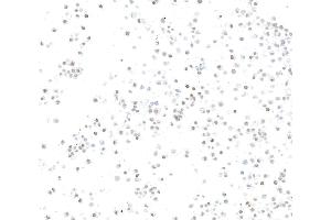 Immunocytochemistry (ICC) image for anti-SWI/SNF Related, Matrix Associated, Actin Dependent Regulator of Chromatin, Subfamily A, Member 2 (SMARCA2) (AA 100-150) antibody (ABIN7795710)