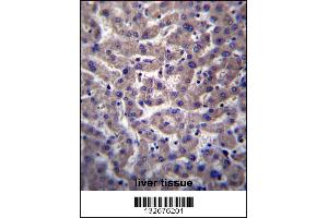 PTGR2 Antibody immunohistochemistry analysis in formalin fixed and paraffin embedded human liver tissue followed by peroxidase conjugation of the secondary antibody and DAB staining. (PTGR2 抗体  (N-Term))