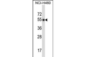 P8 Antibody (N-term) (ABIN657645 and ABIN2846640) western blot analysis in NCI- cell line lysates (35 μg/lane). (MMP8 抗体  (N-Term))
