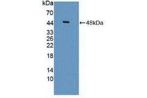 Detection of Recombinant ISLR, Human using Polyclonal Antibody to Immunoglobulin Superfamily Containing Leucine Rich Repeat Protein (ISLR) (ISLR 抗体  (AA 19-428))