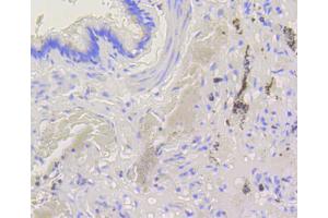 Immunohistochemistry of paraffin-embedded human lung using BAK1 antibody (ABIN4903006) at dilution of 1:100 (40x lens). (BAK1 抗体)