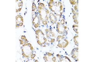 Immunohistochemistry of paraffin-embedded human stomach using ST6GAL1 antibody (ABIN5973377) at dilution of 1/100 (40x lens). (ST6GAL1 抗体)