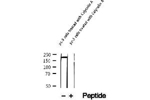 Western blot analysis of extracts of pc-3 cells treated with Calyculin A, using Phospho-KIF1B (Ser1487) Antibody.