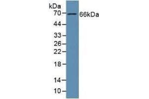 Detection of GAS6 in Human Liver Tissue using Polyclonal Antibody to Growth Arrest Specific Protein 6 (GAS6) (GAS6 抗体  (AA 136-311))