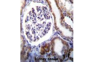 IFT88 Antibody (C-term) immunohistochemistry analysis in formalin fixed and paraffin embedded human kidney tissue followed by peroxidase conjugation of the secondary antibody and DAB staining. (IFT88 抗体  (C-Term))