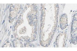 ABIN6267562 at 1/100 staining Human prostate tissue by IHC-P. (Calmodulin 1 抗体  (pSer81, pThr79))