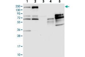 Western blot analysis of Lane 1: RT-4, Lane 2: U-251 MG, Lane 3: Human Plasma, Lane 4: Liver, Lane 5: Tonsil with PDS5B polyclonal antibody  at 1:250-1:500 dilution. (PDS5B 抗体)
