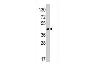 Western blot analysis of RAD9A polyclonal antibody  in HeLa cell line lysates (35 ug/lane).