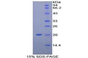 SDS-PAGE (SDS) image for Cyclophilin B (PPIB) (AA 47-216) protein (His tag) (ABIN1878451) (PPIB Protein (AA 47-216) (His tag))